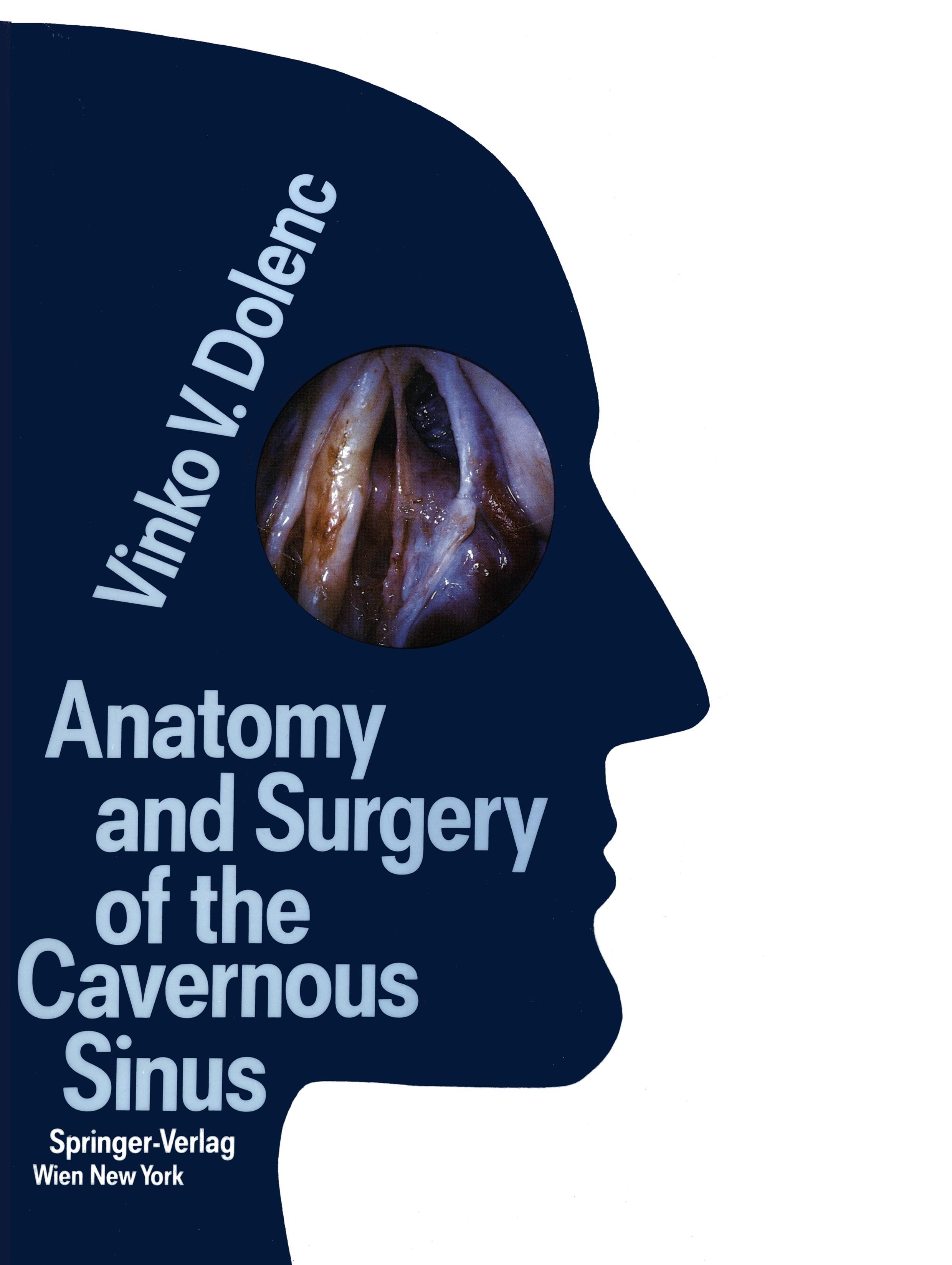 Anatomy and Surgery of the Cavernous Sinus