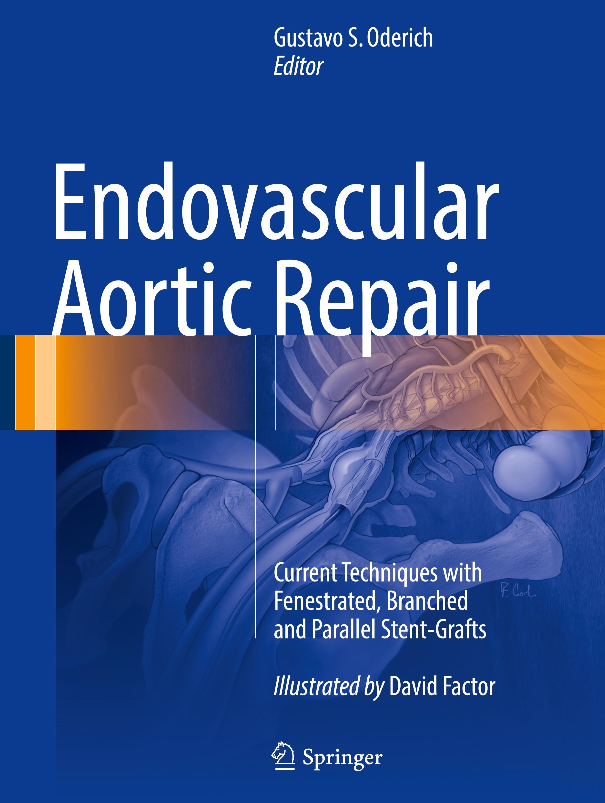 Endovascular Aortic Repair