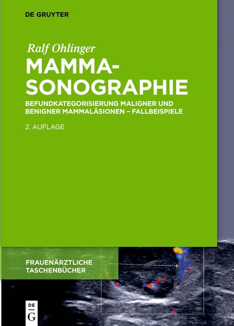 Mammasonographie