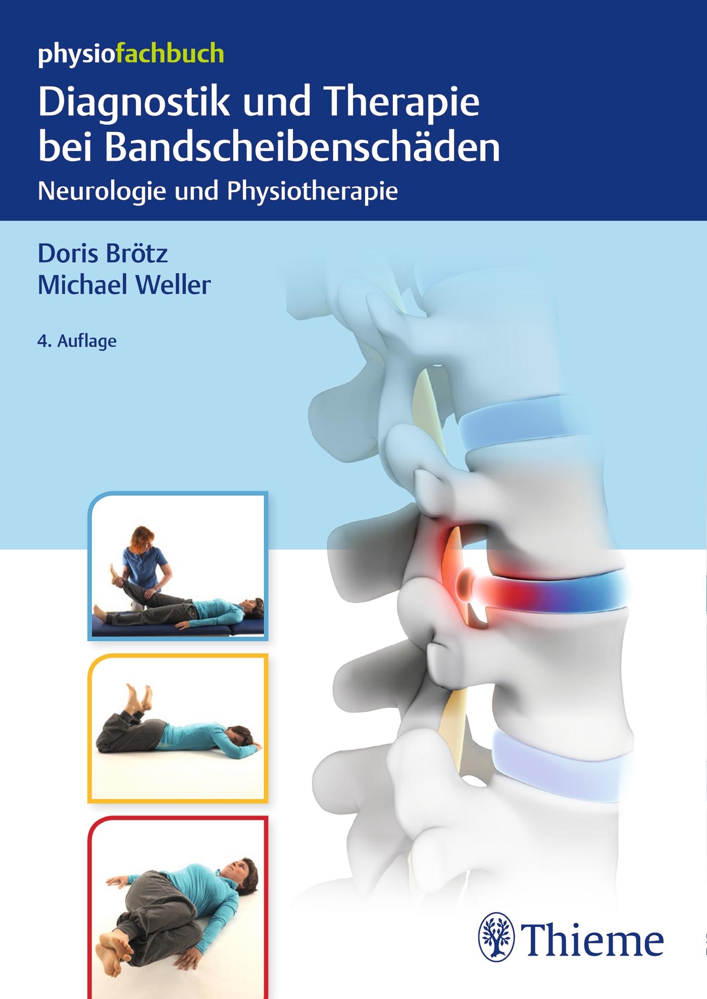 Diagnostik und Therapie bei Bandscheibenschäden