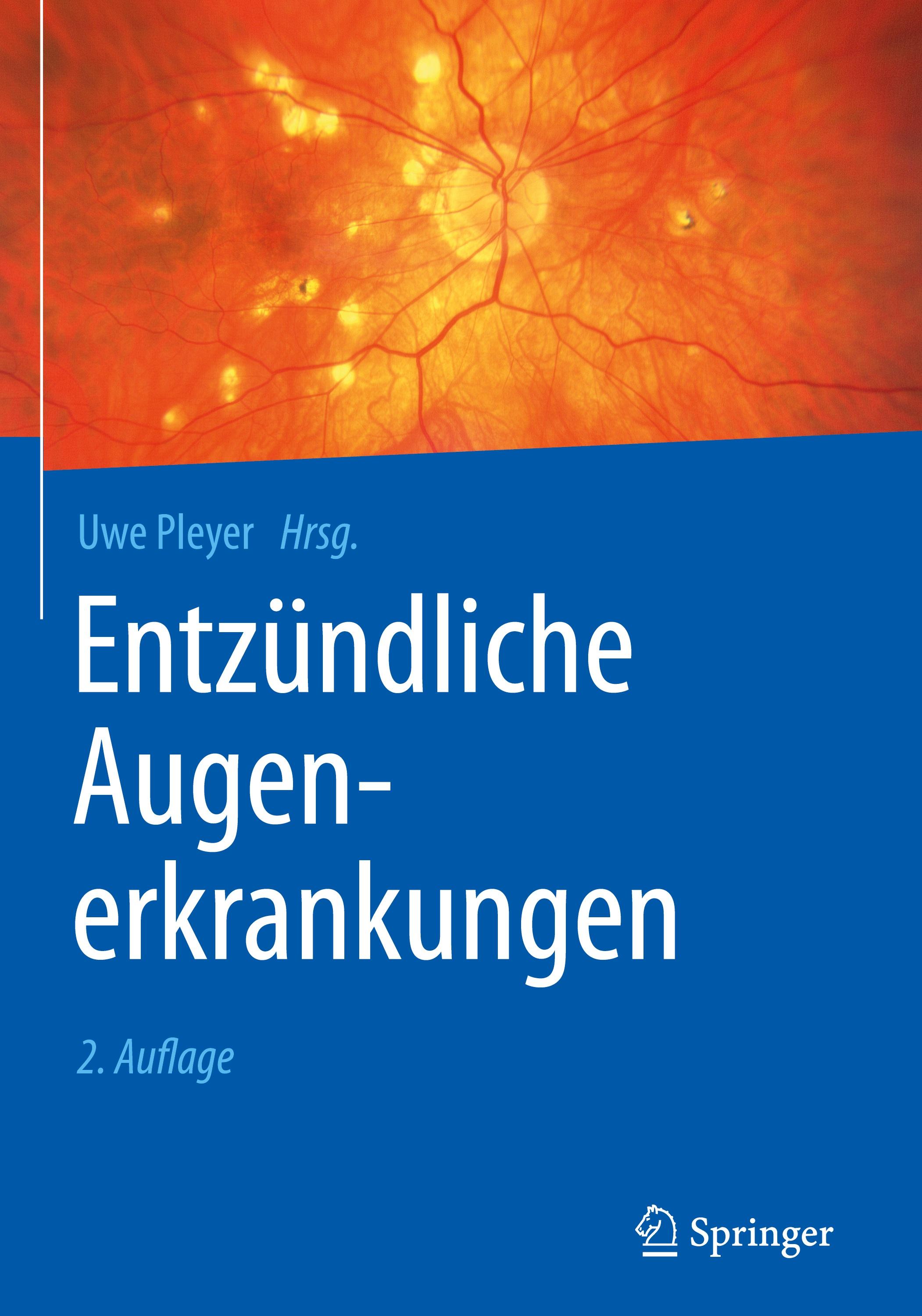 Entzündliche Augenerkrankungen