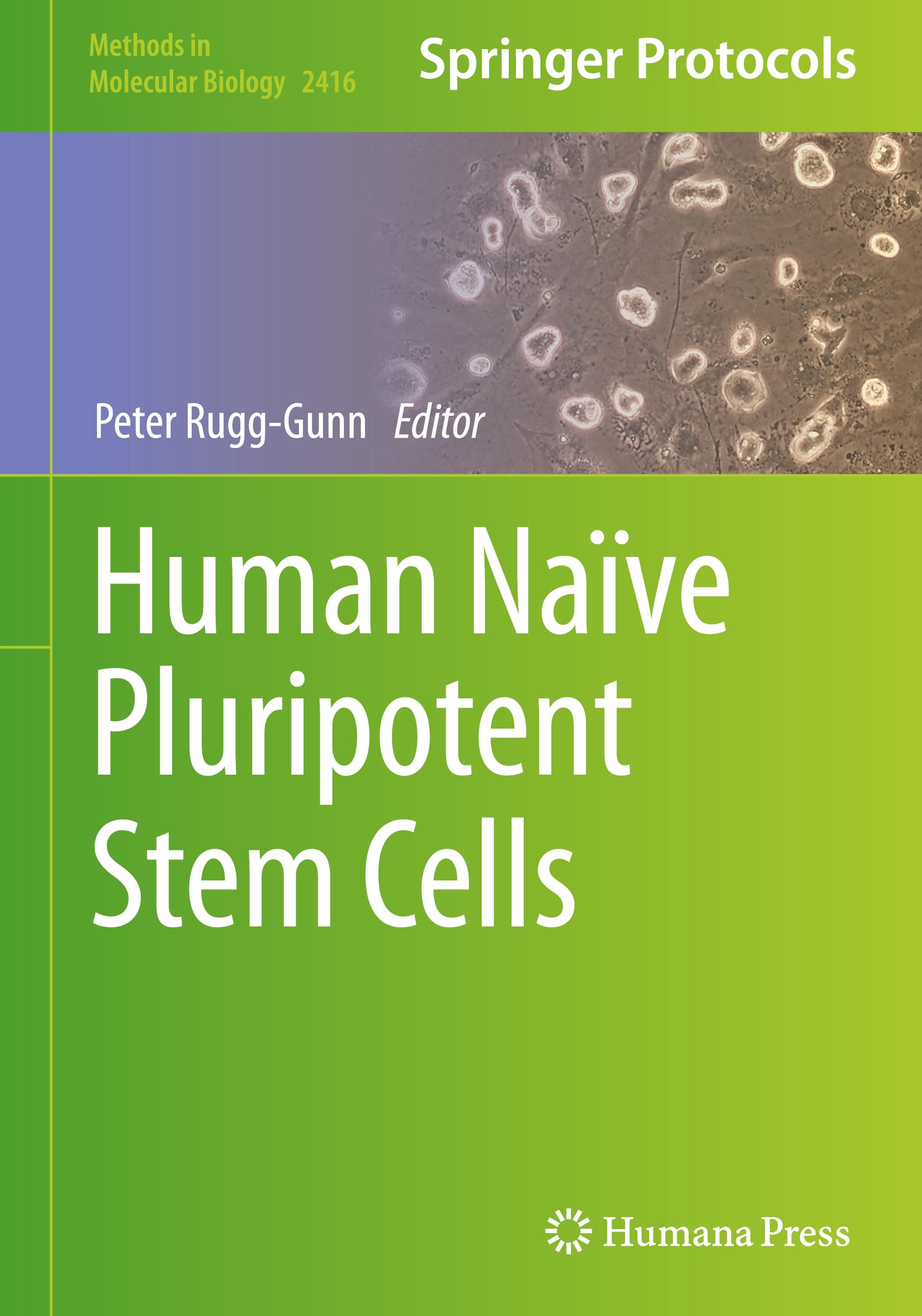 Human Naïve Pluripotent Stem Cells