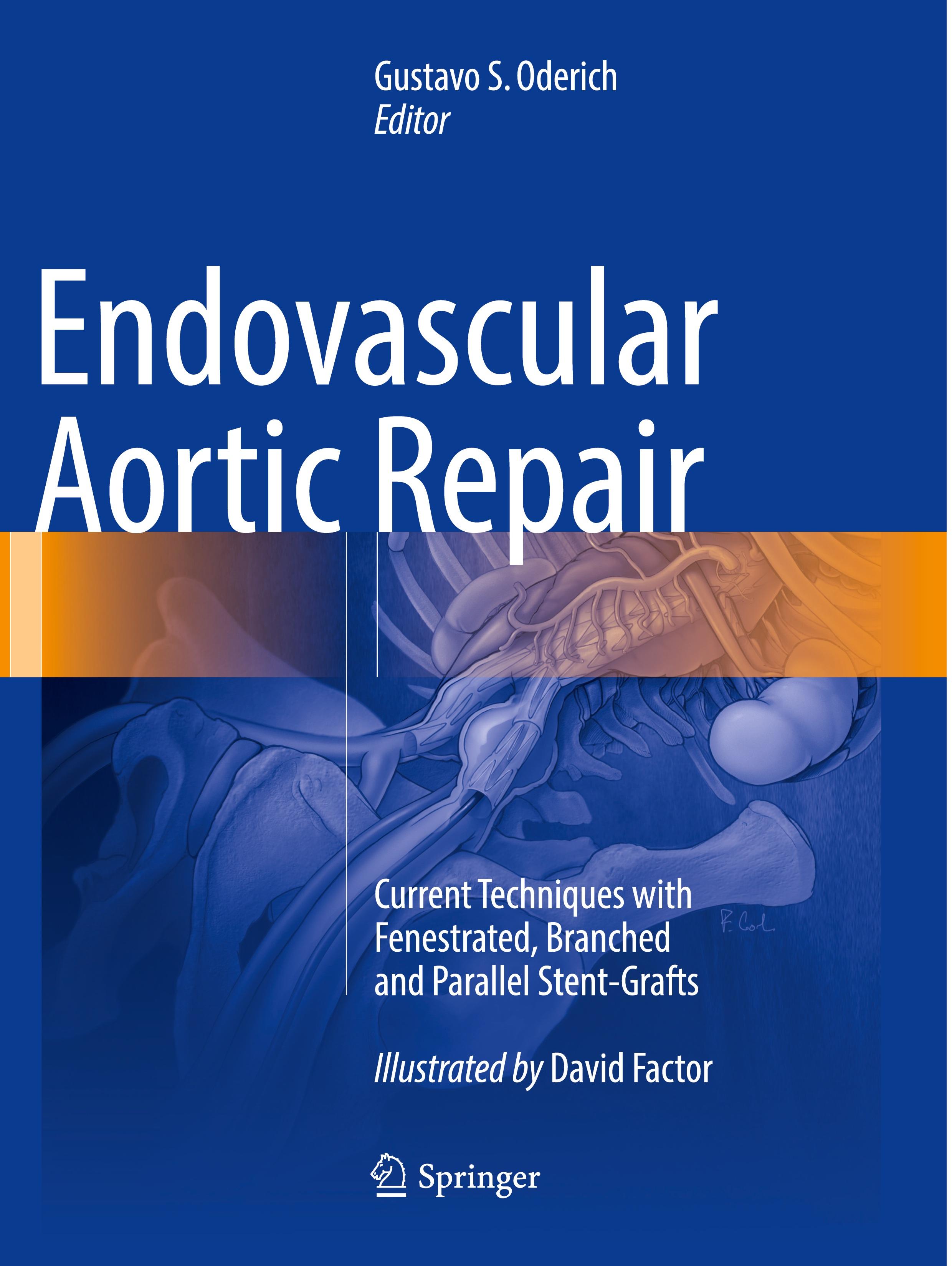 Endovascular Aortic Repair