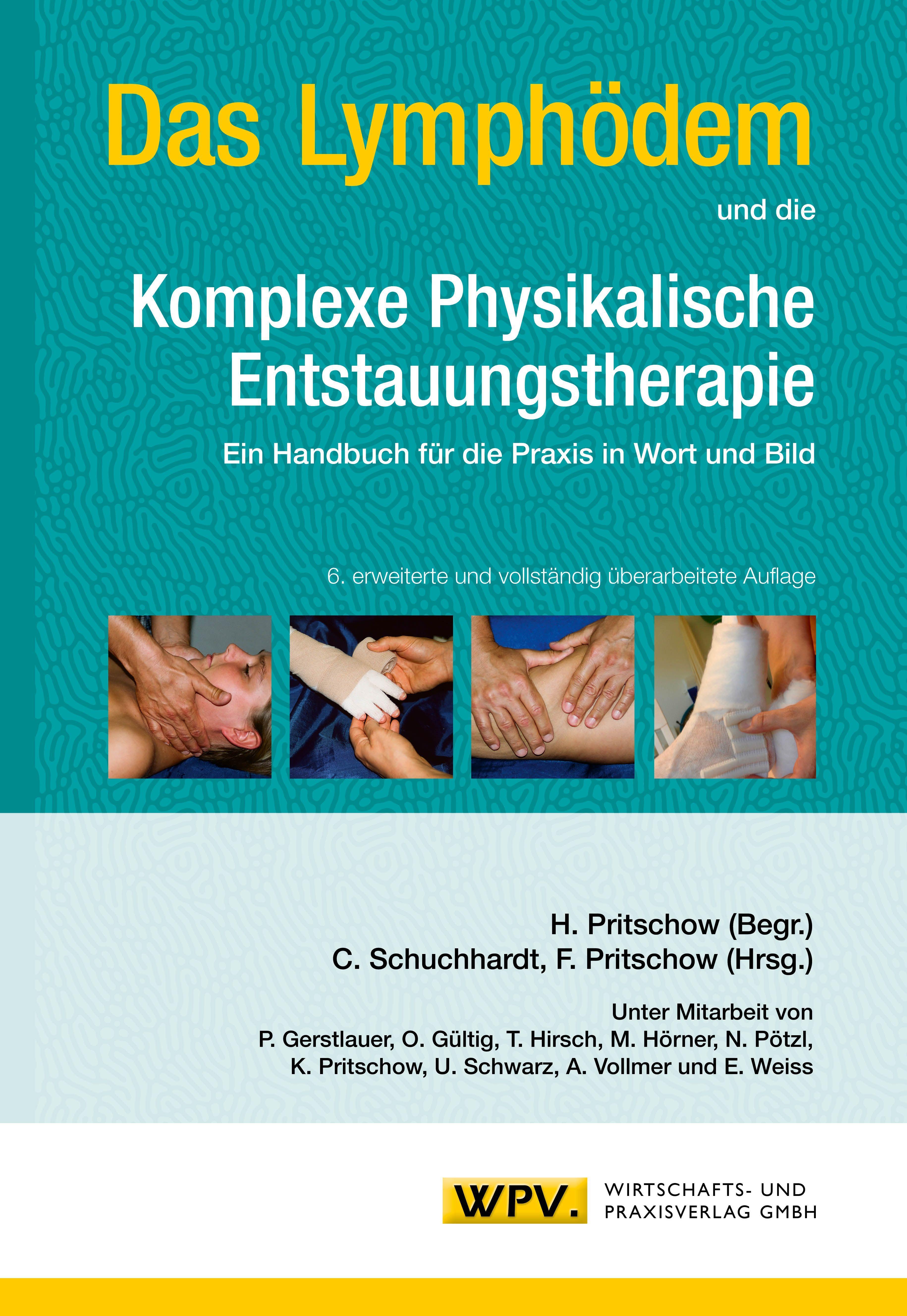 Das Lymphödem und die Komplexe Physikalische Entstauungstherapie