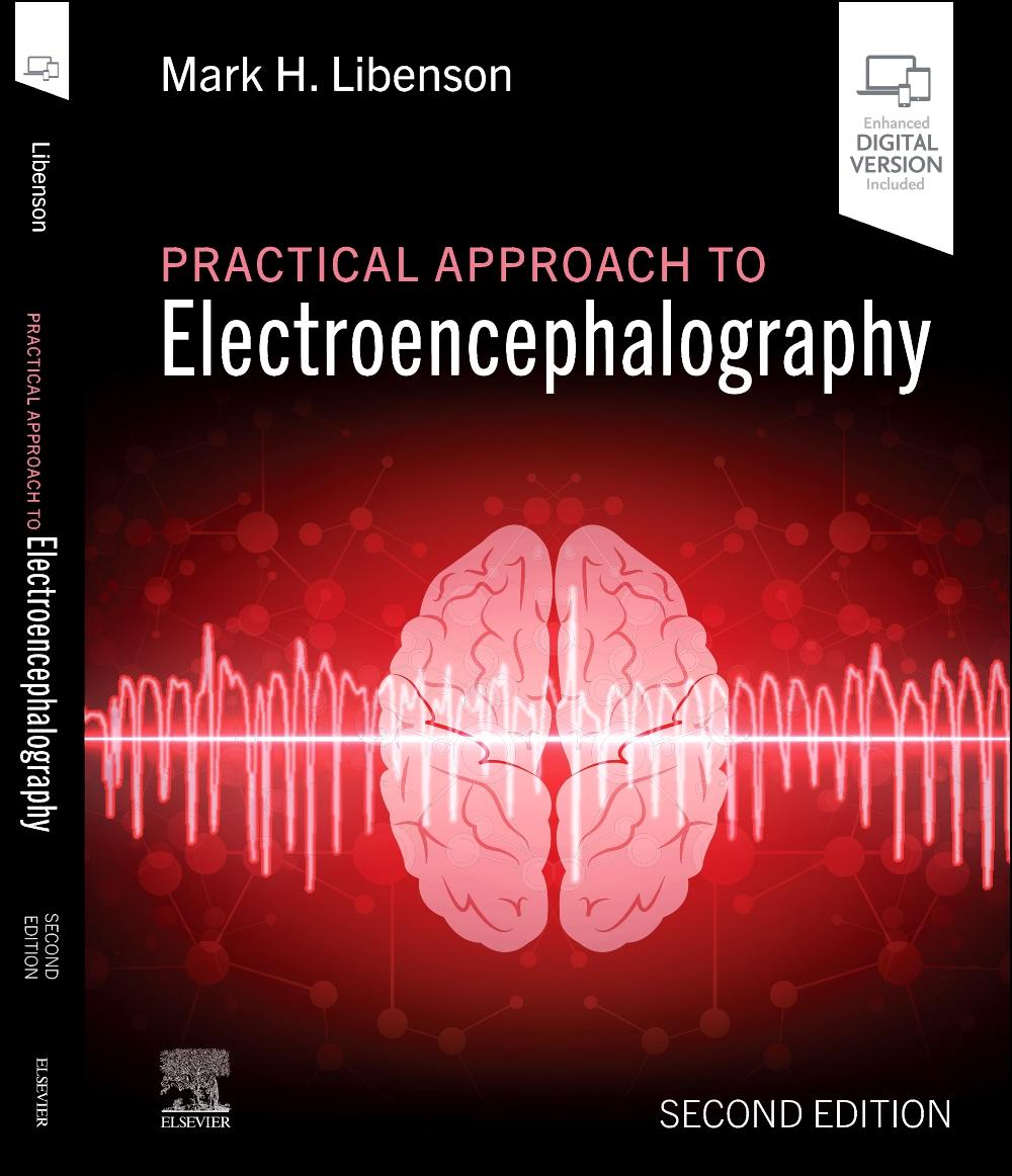 Practical Approach to Electroencephalography