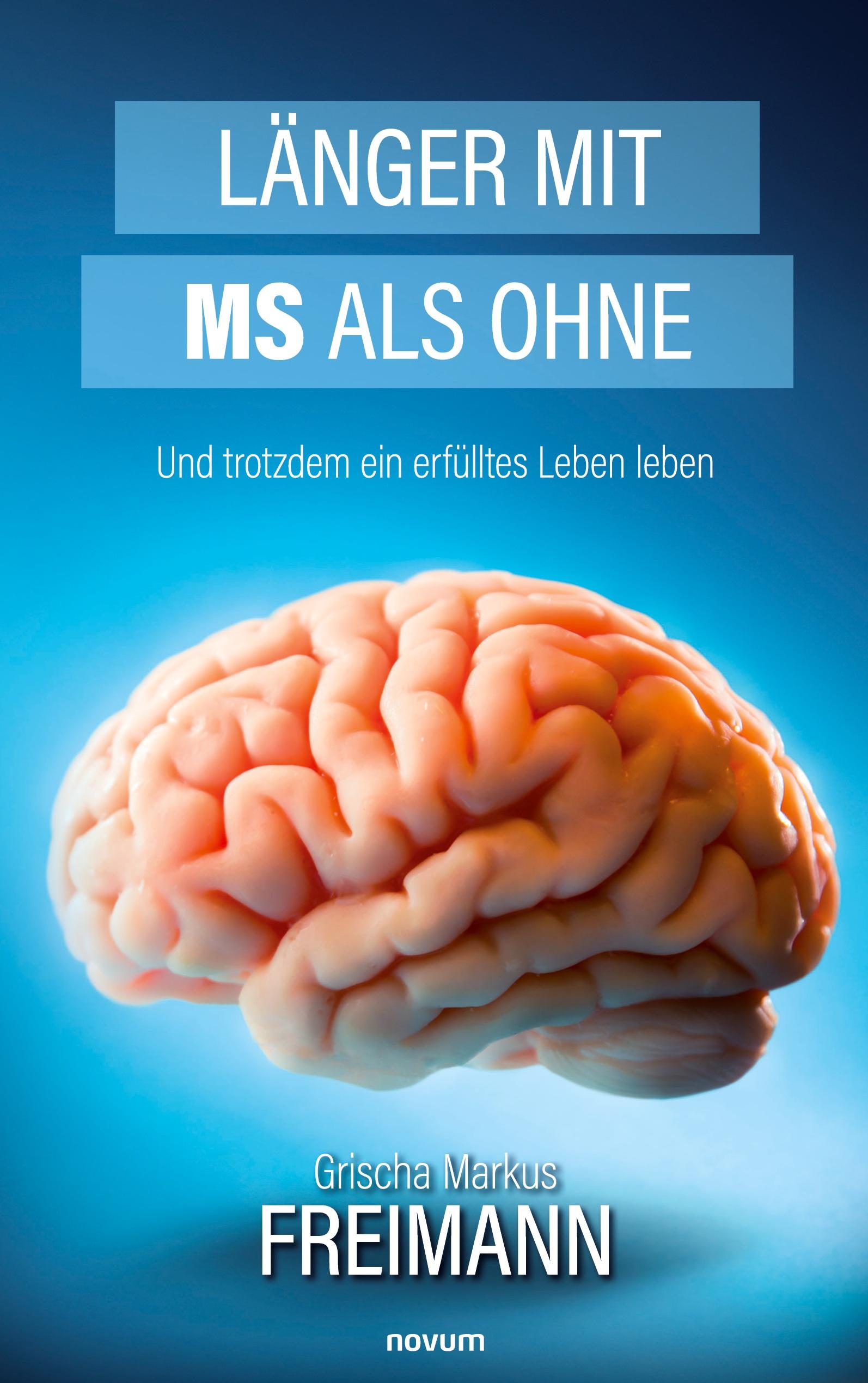 Länger mit MS als ohne