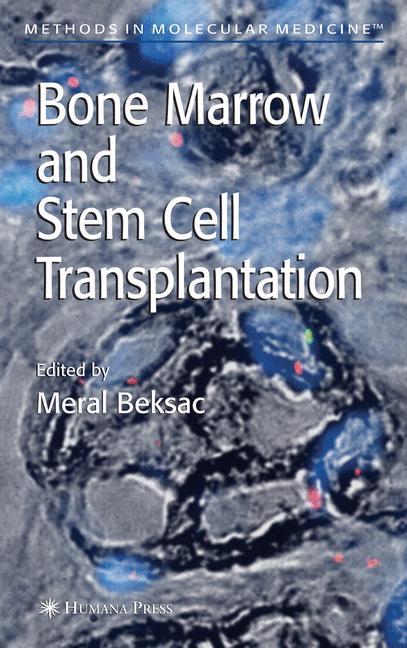 Bone Marrow and Stem Cell Transplantation