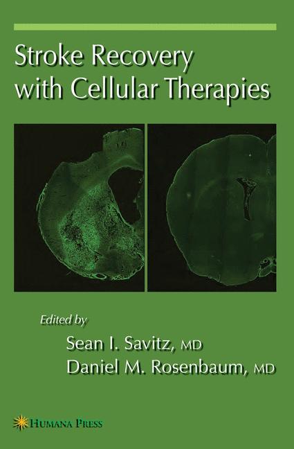 Stroke Recovery with Cellular Therapies