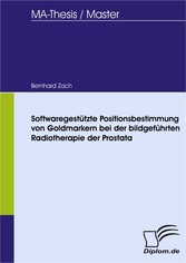 Softwaregestützte Positionsbestimmung von Goldmarkern bei der bildgeführten Radiotherapie der Prostata