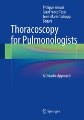 Thoracoscopy for Pulmonologists