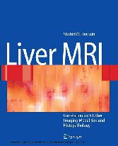 Liver MRI