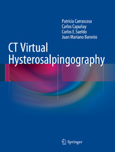 CT Virtual Hysterosalpingography