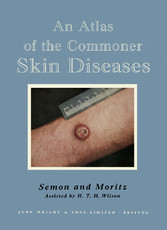 An Atlas of the Commoner Skin Diseases