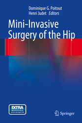 Mini-Invasive Surgery of the Hip