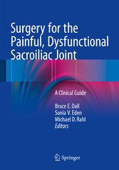 Surgery for the Painful, Dysfunctional Sacroiliac Joint