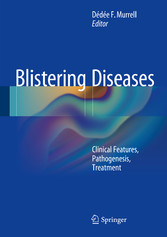 Blistering Diseases