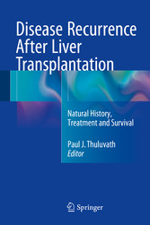 Disease Recurrence After Liver Transplantation