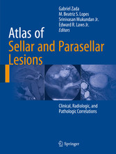 Atlas of Sellar and Parasellar Lesions