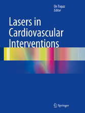 Lasers in Cardiovascular Interventions