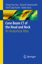 Cone Beam CT of the Head and Neck