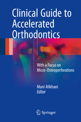 Clinical Guide to Accelerated Orthodontics