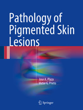 Pathology of Pigmented Skin Lesions