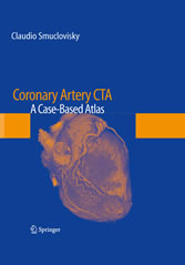 Coronary Artery CTA