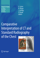 Comparative Interpretation of CT and Standard Radiography of the Chest