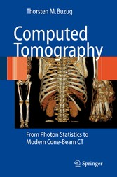 Computed Tomography