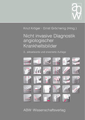 Nicht invasive Diagnostik angiologischer Krankheitsbilder