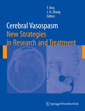 Cerebral Vasospasm