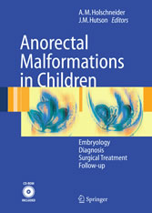 Anorectal Malformations in Children