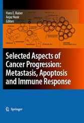 Selected Aspects of Cancer Progression: Metastasis, Apoptosis and Immune Response