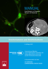 Knochentumoren und Weichteilsarkome