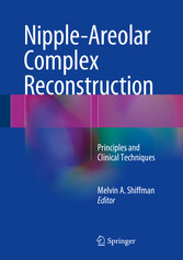 Nipple-Areolar Complex Reconstruction