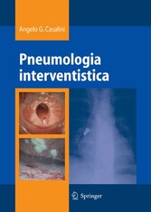 Pneumologia interventistica