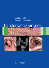 La colonscopia virtuale