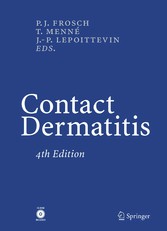 Contact Dermatitis