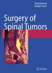 Surgery of Spinal Tumors