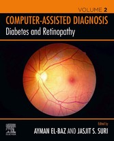 Diabetes and Retinopathy