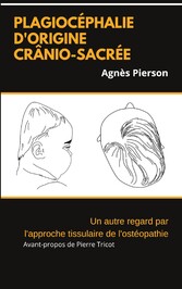 plagiocéphalie d&apos;origine crânio-sacrée