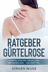 Ratgeber Gürtelrose