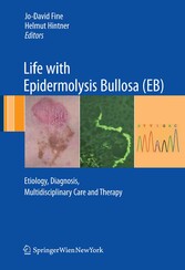 Life with Epidermolysis Bullosa (EB)