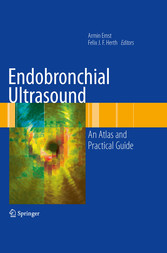 Endobronchial Ultrasound