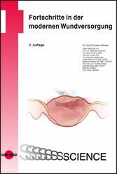 Fortschritte in der modernen Wundversorgung