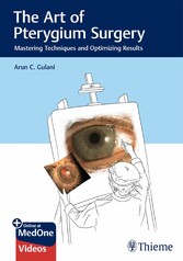 The Art of Pterygium Surgery