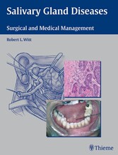 Salivary Gland Diseases