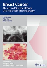 Breast Cancer - The Art and Science of Early Detection with Mammography