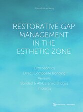 Restorative Gap Management in the Esthetic Zone