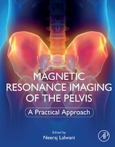 Magnetic Resonance Imaging of The Pelvis